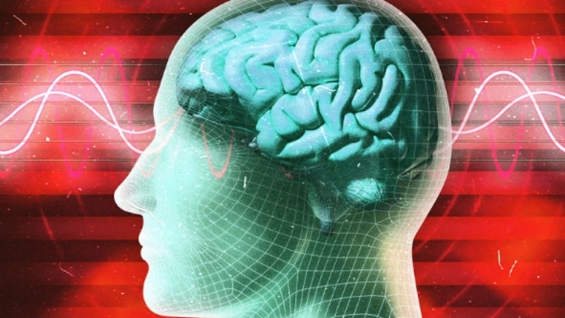 Generic placeholder image